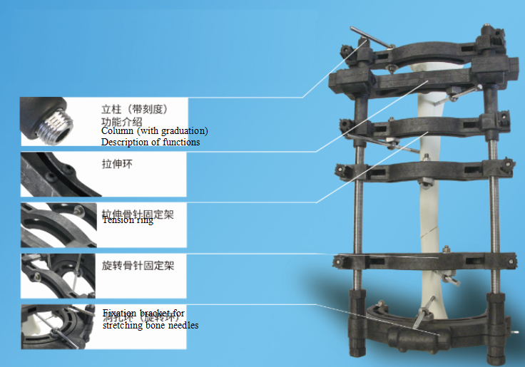 Worm and gear set 3D external fixation bracket for restoration 