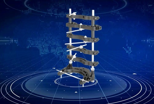 Demonstration animation of orthopedic external fixator 